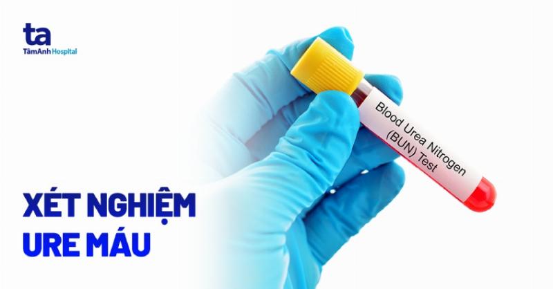 Urea Là Chỉ Số Gì? Hiểu Rõ Về Urea Máu Và Ý Nghĩa Sức Khỏe Của Bạn