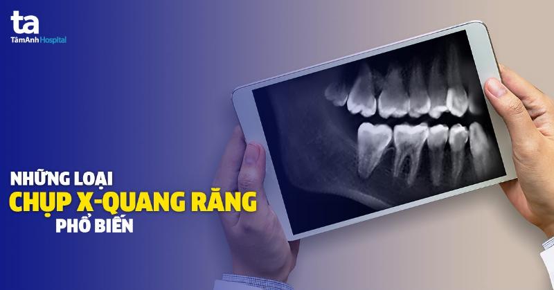 Hình ảnh một phòng khám nha khoa hiện đại với các thiết bị chẩn đoán (máy X-quang) và ghế nha