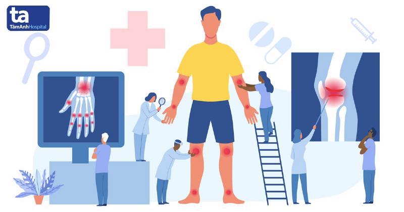 Minh họa việc tập thể dục giúp phòng ngừa đau đầu gối, bằng cách tăng cường cơ bắp và sự linh hoạt