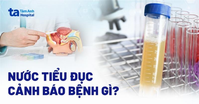 Hình ảnh minh họa các biện pháp phòng ngừa nước tiểu vàng đục ở nữ giới