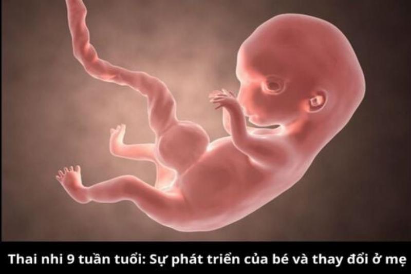 Xét nghiệm tiểu đường thai kỳ bao nhiêu tuần: Mốc thời gian mẹ bầu cần ghi nhớ