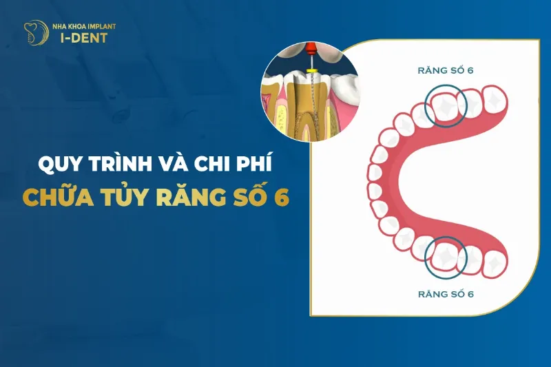Quy trinh nieng rang ho va chi phi tung buoc dieu tri