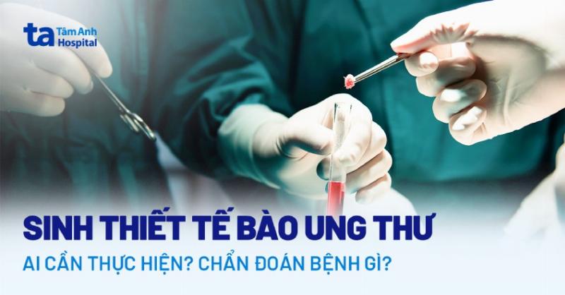 Quy trình sinh thiết cổ tử cung được thực hiện để xác định bản chất của cục sờ thấy