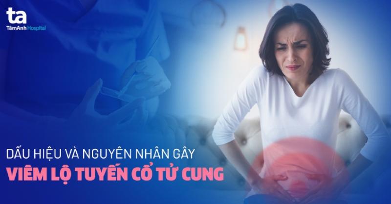 Sơ đồ các bước khám và xét nghiệm chẩn đoán viêm lộ tuyến cổ tử cung