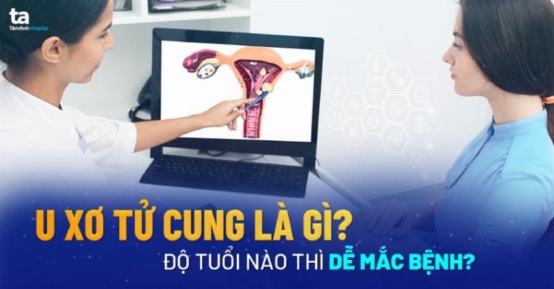 U Xơ Tử Cung Kích Thước Bao Nhiêu Thì Mổ? Giải Đáp Chi Tiết Từ Chuyên Gia