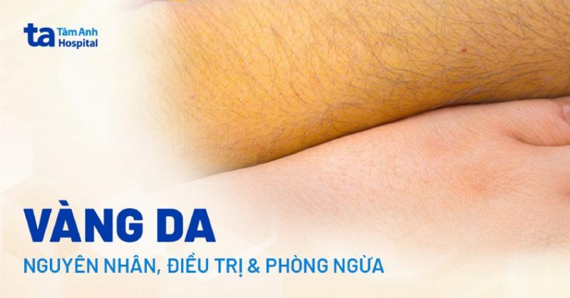 Giải Mã Nhu Mô Gan Thô Sống Được Bao Lâu: Thông Tin Cần Biết
