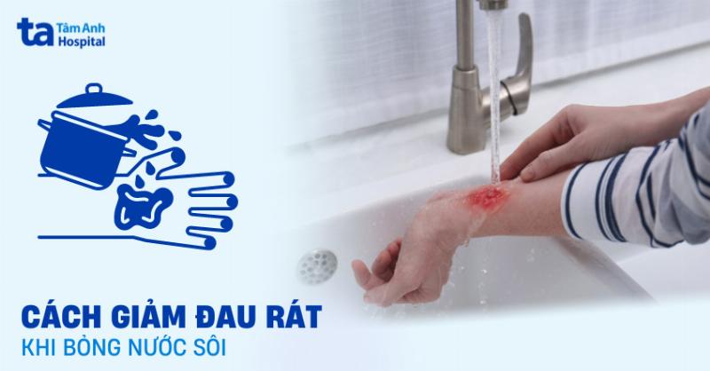 Bị Bỏng Thì Nên Làm Gì? Hướng Dẫn Xử Lý Vết Bỏng Chuẩn Y Khoa