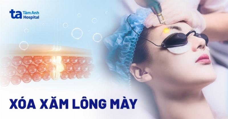 So sánh khuôn mặt trước và sau khi bắn laser điều trị sẹo rỗ