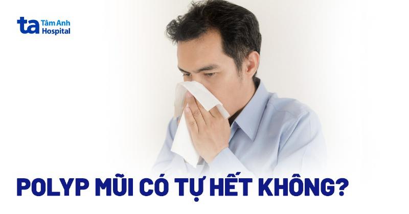 Bang so sanh cac lua chon dieu tri noi khoa pho bien cho cuc thit trong mui