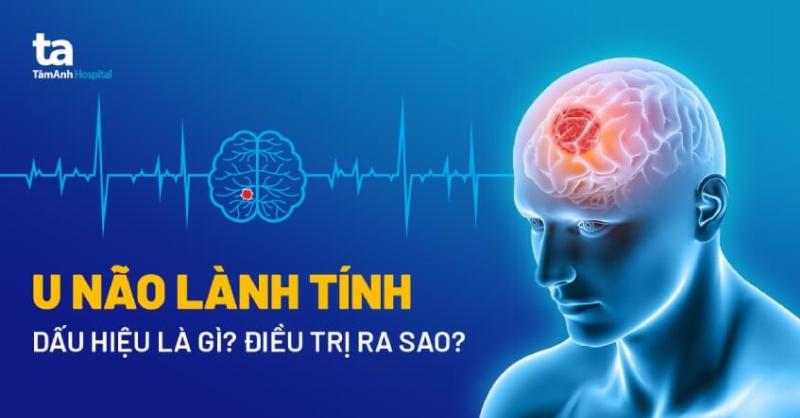 U Ác Tính Sống Được Bao Lâu? Hiểu Đúng Về Tiên Lượng Ung Thư