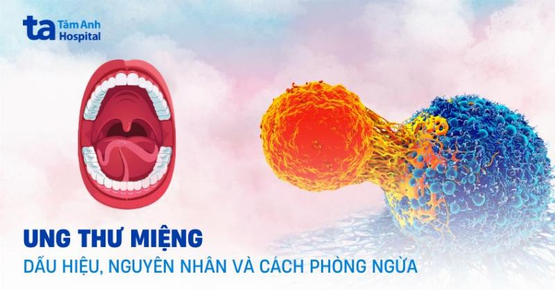 Hinh anh minh hoa cac van de rang mieng do xa tri vung dau mat co gay ra