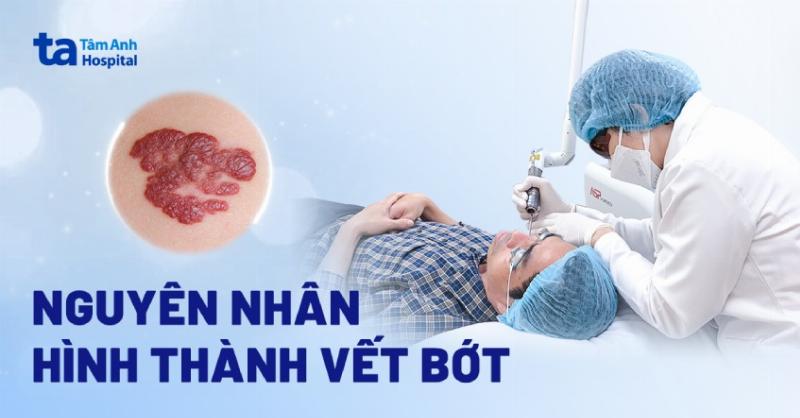 Giải mã hình ảnh các loại bớt ở trẻ sơ sinh: Cha mẹ cần biết