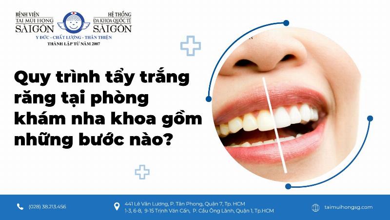 Không Chỉ Cách Dưỡng Trắng Da Mặt: Bí Quyết Nâng Tầm Nụ Cười Bừng Sáng Từ Nha Khoa Bảo Anh