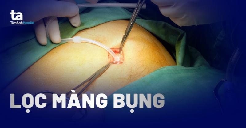 Sơ đồ thẩm phân phúc mạc