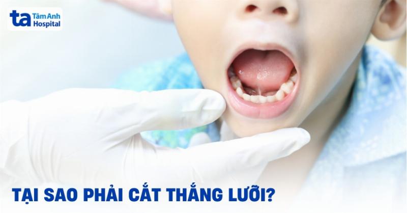 Thắng môi trên ở trẻ sơ sinh bình thường: Ba mẹ hiểu đúng để an tâm chăm sóc con yêu
