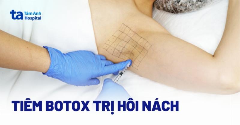 Tìm đến chuyên gia khi trị hôi nách tại nhà không hiệu quả.