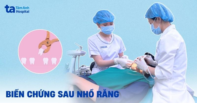 Thuốc Tê Nhổ Răng Bao Lâu Thì Hết? Giải Đáp Chi Tiết Từ Chuyên Gia