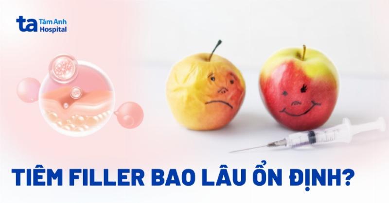 Khoảng thời gian cần kiêng kỵ sau khi tiêm filler để đảm bảo kết quả thẩm mỹ bền vững và an toàn