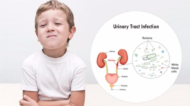 Cách Lấy Nước Tiểu Nhanh: Bí Quyết Thu Mẫu Chuẩn Xác