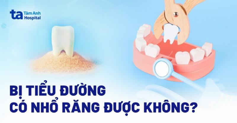 Mối liên hệ giữa bệnh tiểu đường và sức khỏe răng miệng.