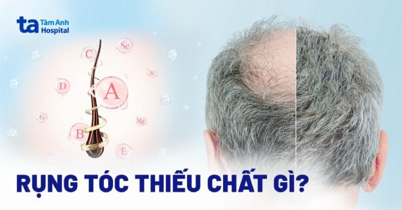 Trẻ Bị Rụng Tóc Là Thiếu Chất Gì? Giải Mã Nguyên Nhân và Cách Khắc Phục