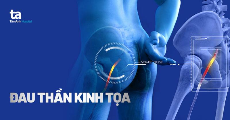 Đau Cột Sống Lưng Dưới: Hiểu Rõ Nguyên Nhân Và Khi Nào Cần Gặp Bác Sĩ