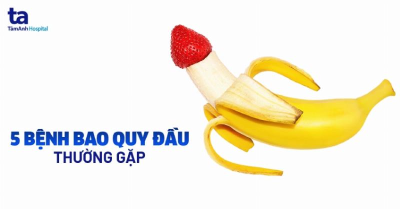Cach tu kiem tra bao quy dau dai tai nha