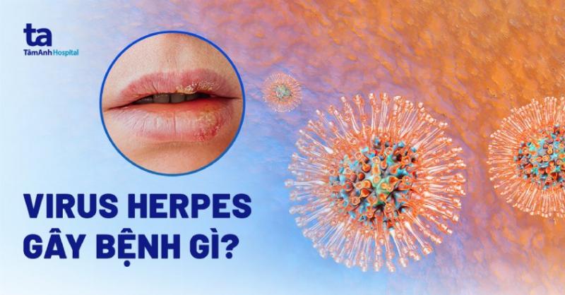 Nhìn Thấu Hình Ảnh Mụn Rộp Sinh Dục Nam: Hiểu Đúng, Đừng Hoang Mang!