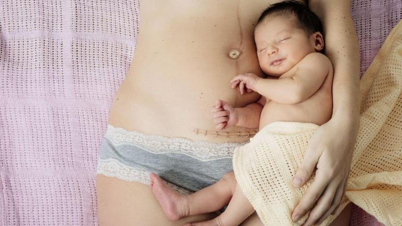Dấu hiệu nhiễm trùng vết mổ bên trong sau sinh: Nhận biết sớm, an tâm phục hồi
