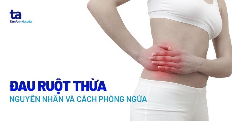 Hình ảnh minh họa vị trí điển hình đau ruột thừa, thường ở bụng dưới bên phải