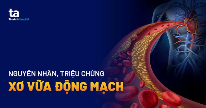Rối Loạn Chuyển Hóa Lipid: Mối Nguy Tiềm Ẩn Mà Bạn Cần Biết