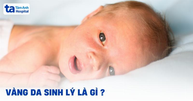 Trị Vàng Da Cho Trẻ Sơ Sinh Tại Nhà: Hiểu Đúng & Làm An Toàn