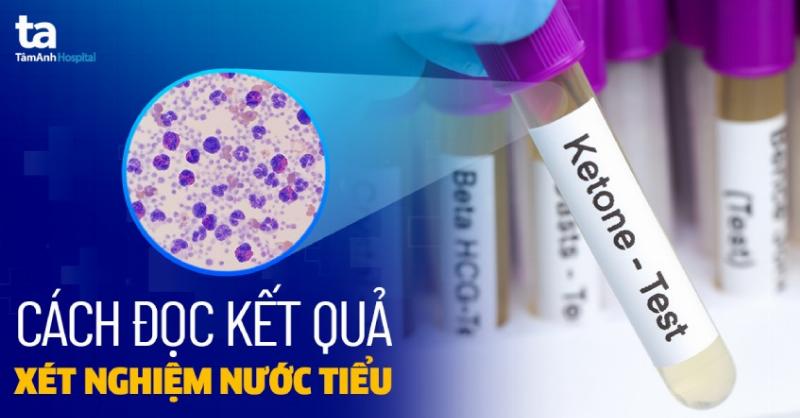 Đọc Kết Quả Xét Nghiệm Nước Tiểu Chuẩn Y Khoa: Cẩm Nang Toàn Diện