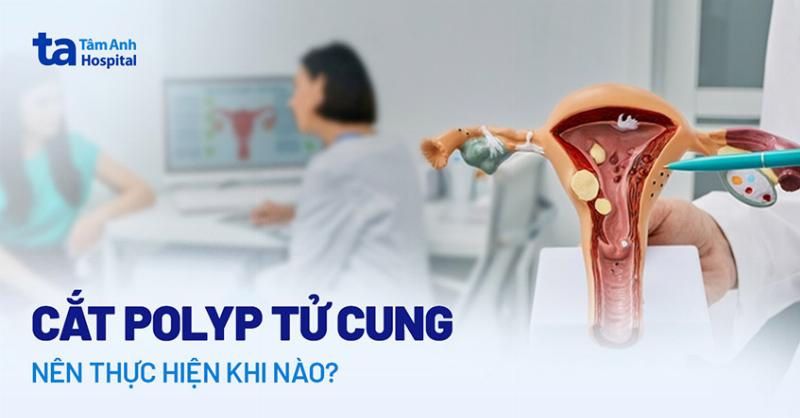 Polyp Tử Cung: Thuốc Điều Trị Có Thực Sự Hiệu Quả?
