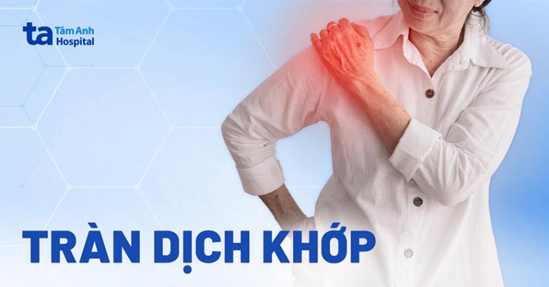 Hình ảnh minh họa các bệnh lý khớp gối là nguyên nhân gây tràn dịch
