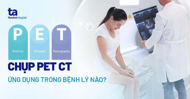 Hình ảnh minh họa một bệnh nhân uống nước sau khi chụp CT