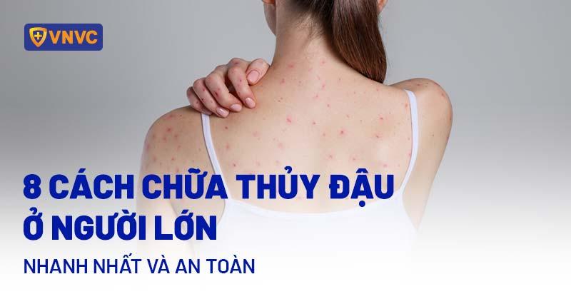 Hình ảnh minh họa biến chứng viêm phổi do thủy đậu ở người lớn (hình ảnh X-quang hoặc mô phỏng)