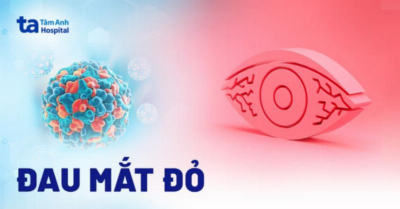 Hình minh họa các biện pháp phòng ngừa đau mắt đỏ: Rửa tay, tránh chạm mắt, không dùng chung đồ dùng