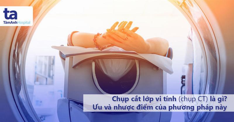 Chụp CT Bụng Có Cản Quang Giá Bao Nhiêu? Hiểu Rõ Từ A Đến Z