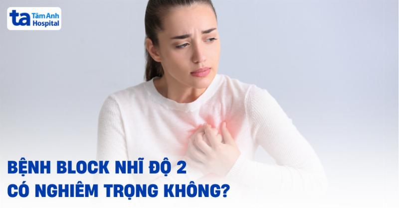 Block AV Độ 2 Mobitz 2: Hiểu Rõ Về Rối Loạn Dẫn Truyền Điện Tim