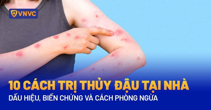 Minh họa các bước chăm sóc người bệnh thủy đậu tại nhà (ví dụ: tắm, bôi thuốc, nghỉ ngơi)