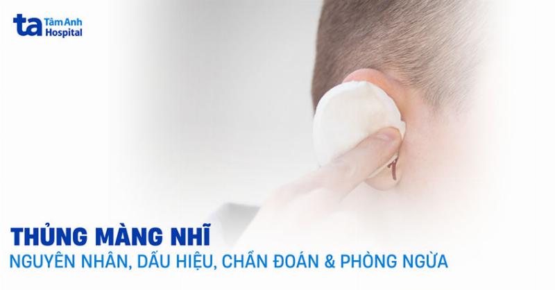 Biểu đồ minh họa các yếu tố ảnh hưởng đến chi phí phẫu thuật vá màng nhĩ