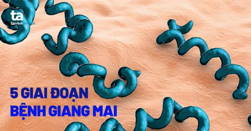Các Giai Đoạn Giang Mai: Hiểu Rõ “Hành Trình” Của Căn Bệnh