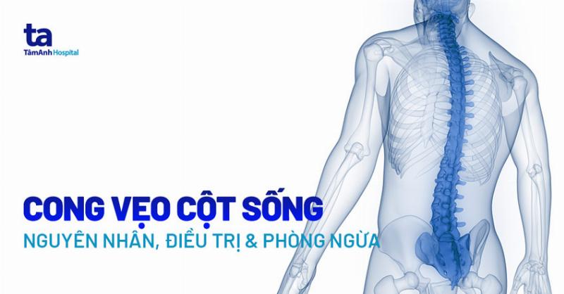 Giải Mã Hiện Tượng Cơ Thể Bạn: Làm Sao Để Cứ Cong Lên?