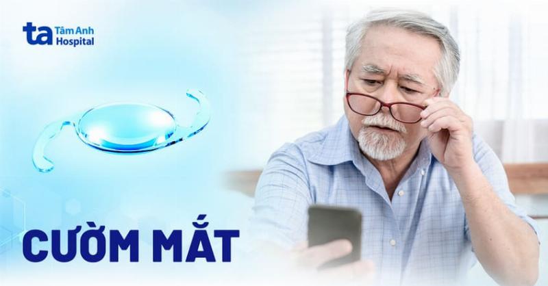 Dấu hiệu và triệu chứng mắt bị cườm nước bạn cần nhận biết sớm