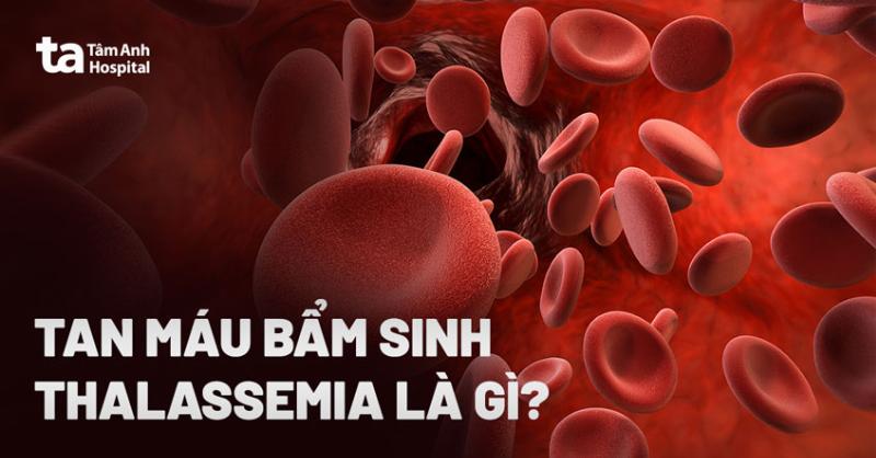 Hiểu Rõ Về Thiếu Máu Hồng Cầu Nhỏ Thalassemia: Căn Bệnh Di Truyền Cần Lưu Tâm