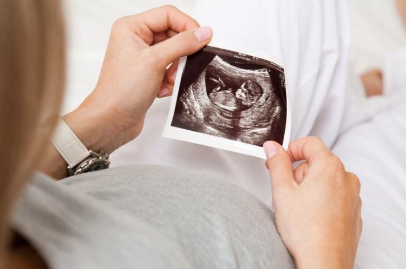 Đo Độ Mờ Da Gáy Khi Nào Chuẩn Nhất? Thời Điểm Vàng Cho Mẹ Bầu