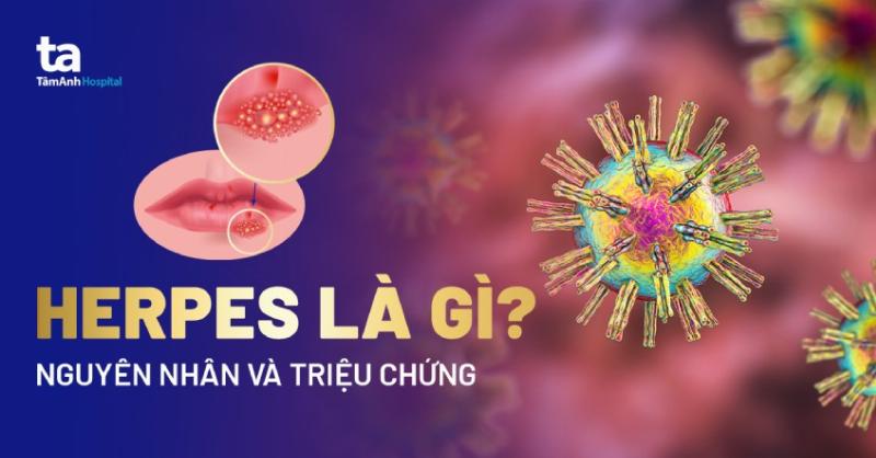 Nổi Mụn Rộp Toàn Thân: Hiểu Rõ Bệnh Herpes & Những Điều Cần Biết