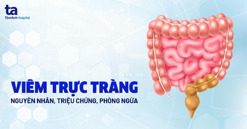 Cách Chữa Viêm Đại Tràng: Hiểu Rõ Để Sống Khỏe Mạnh Hơn