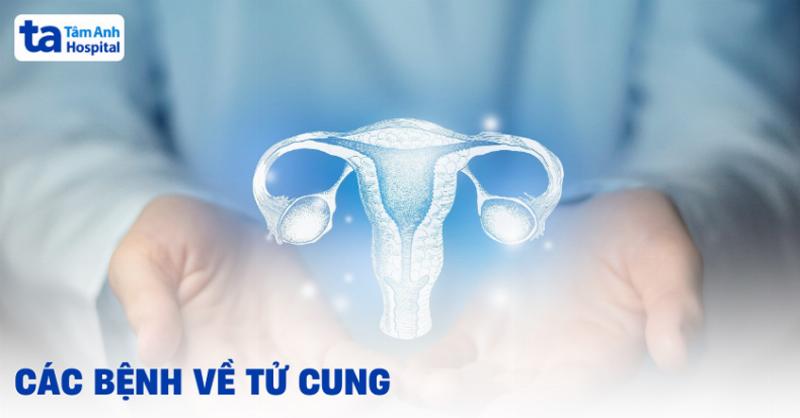 Giải đáp các câu hỏi thường gặp về viêm lộ tuyến cổ tử cung một cách súc tích và dễ hiểu